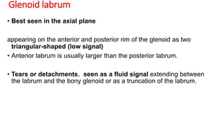Glenoid labrum
• Best seen in the axial plane
appearing on the anterior and posterior rim of the glenoid as two
triangular-shaped (low signal)
• Anterior labrum is usually larger than the posterior labrum.
• Tears or detachments, seen as a fluid signal extending between
the labrum and the bony glenoid or as a truncation of the labrum.
 