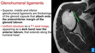 Glenohumeral ligaments
• Superior, middle and inferior
glenohumeral ligaments are thickenings
of the glenoid capsule that attach onto
the anteroinferior margin of the
glenoid labrum
• Uniform structure on a T1 axial image,
appearing as a dark band near the
anterior labrum, that extends along the
humeral head
 