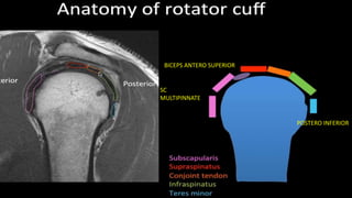 SC
MULTIPINNATE
BICEPS ANTERO SUPERIOR
POSTERO INFERIOR
 