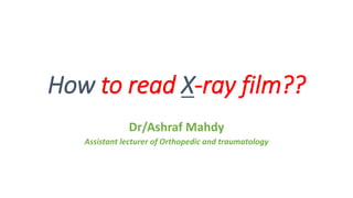 How to read X-ray film??
Dr/Ashraf Mahdy
Assistant lecturer of Orthopedic and traumatology
 