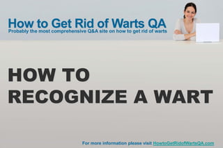 HOW TO
RECOGNIZE A WART

     For more information please visit HowtoGetRidofWartsQA.com
 