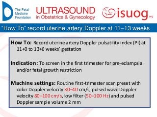 How To: Record uterine artery Doppler pulsatility index (PI) at
11+0 to 13+6 weeks’ gestation
Indication: To screen in the first trimester for pre-eclampsia
and/or fetal growth restriction
Machine settings: Routine first-trimester scan preset with
color Doppler velocity 30–40 cm/s, pulsed wave Doppler
velocity 80–100 cm/s, low filter (50–100 Hz) and pulsed
Doppler sample volume 2 mm
“How To” record uterine artery Doppler at 11–13 weeks
 