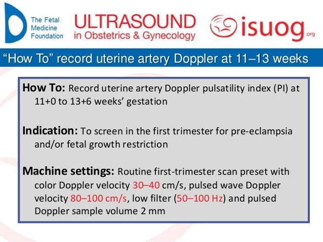 Doppler In First Trimester _ First-trimester uterine artery Doppler and ...