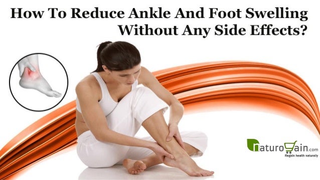 How To Reduce Ankle And Foot Swelling Without Any Side Effects?