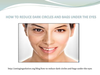http://antiagingsolution.org/blog/how-to-reduce-dark-circles-and-bags-under-the-eyes
 