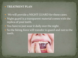  TREATMENT PLAN
 We will provide a NIGHT GUARD for these cases.
 Night guard is a transparent material comes with the
replica of your teeth.
 You have to just wear it daily over the night.
 So the biting force will transfer to guard and not to the
teeth.
 