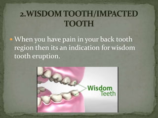  When you have pain in your back tooth
region then its an indication for wisdom
tooth eruption.
 