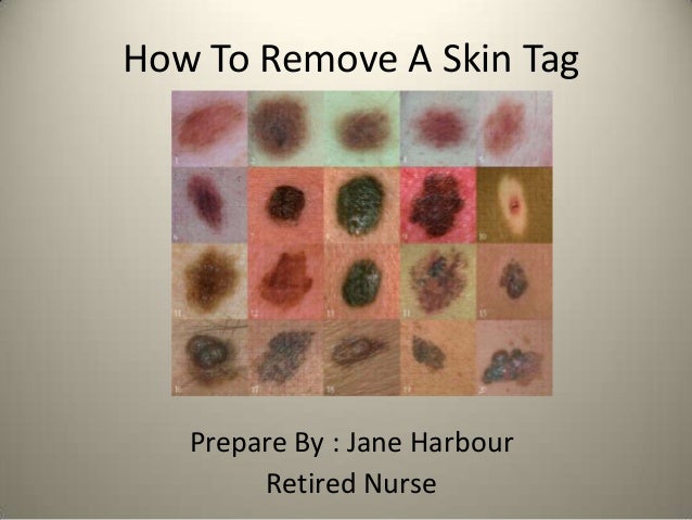 how to remove a