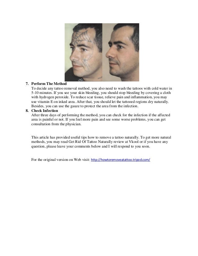 how to remove a tattoo effectively at home how to remove a tattoo effectively at home