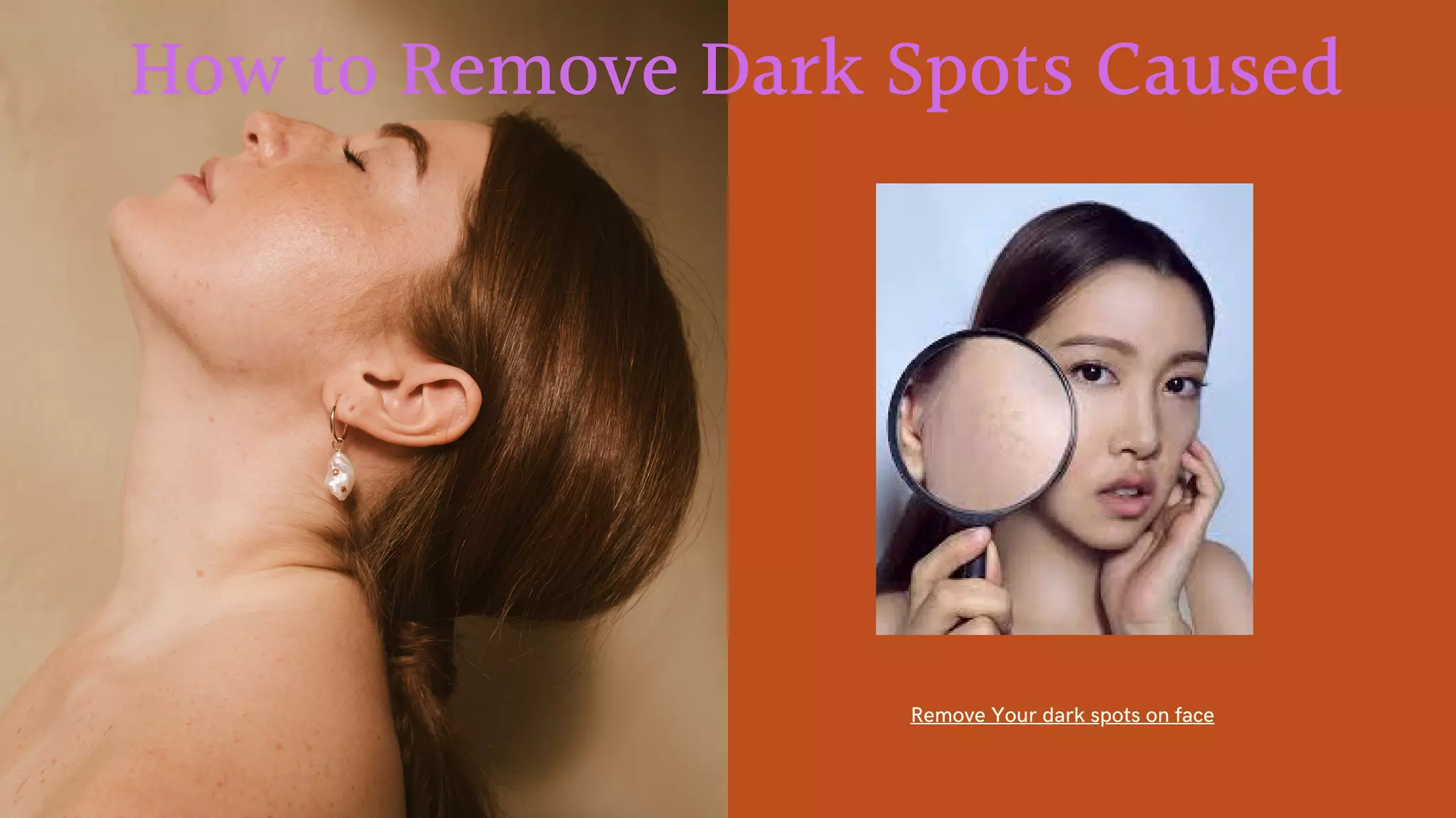 How To Remove Dark Spots Caused By Pimples On Face PPT