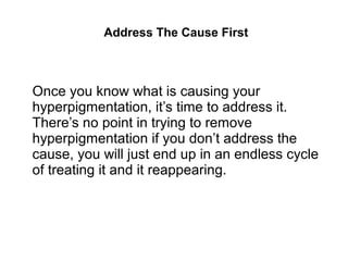 Address The Cause First
Once you know what is causing your
hyperpigmentation, it’s time to address it.
There’s no point in trying to remove
hyperpigmentation if you don’t address the
cause, you will just end up in an endless cycle
of treating it and it reappearing.
 
