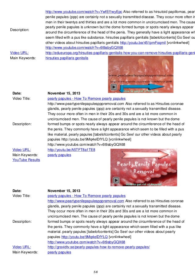 How to remove pearly penile papules at home