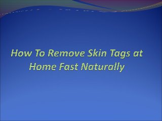 How To Remove Skin Tags at Home Fast Naturally
Skin tags can be a significant cause of discomfort and

being embarrassed ...
