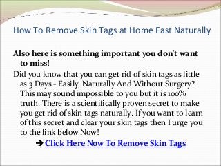 How To Remove Skin Tags at Home Fast Naturally