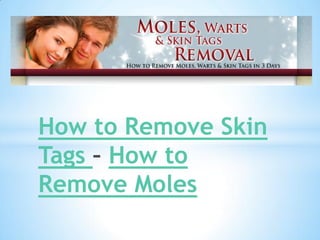 How to Remove Skin
Tags How to
Remove Moles
 