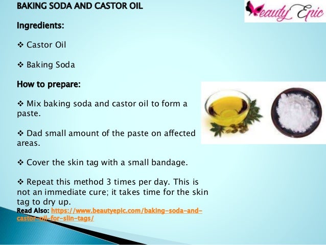 How To Remove Skin Tags With Baking Soda And Castor Oil remove skin tags with baking soda