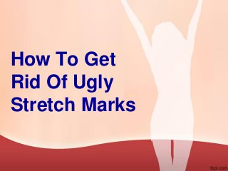 How To Get
Rid Of Ugly
Stretch Marks
 