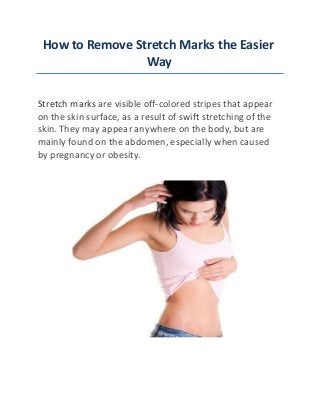 How to Remove Stretch Marks the Easier
Way
Stretch marks are visible off-colored stripes that appear
on the skin surface, as a result of swift stretching of the
skin. They may appear anywhere on the body, but are
mainly found on the abdomen, especially when caused
by pregnancy or obesity.
 