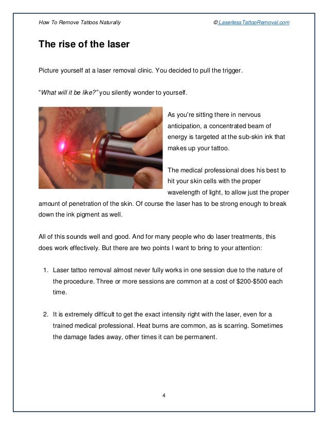 Get Rid Tattoo Naturally Get Rid Tattoo Naturally
