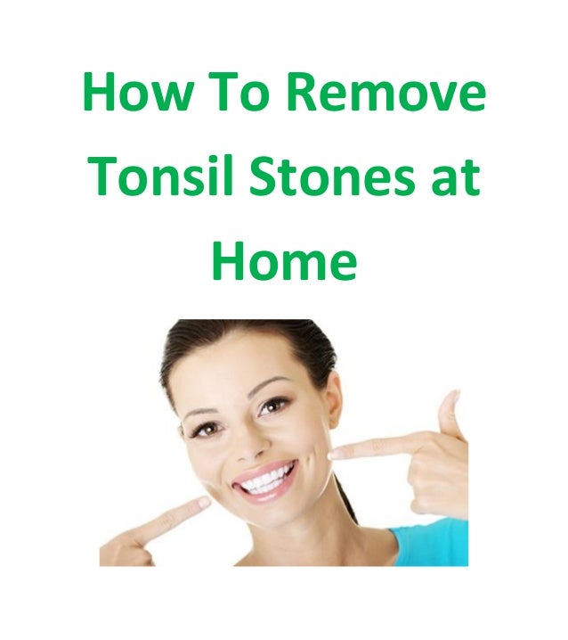 How to remove tonsil stones at home
