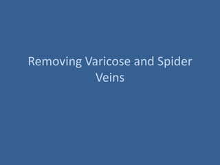 Removing Varicose and Spider
           Veins
 