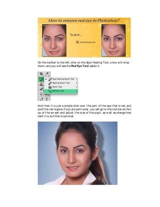 On the toolbar to the left, click on the Spot Healing Tool, a box will drop
down, and you will see the Red Eye Tool, select it.
And t hen it is just a simple click over t he part of t he eye t hat is red, and
poof t he r ed is gone. If you ar e part i cular , you can go t o t he t ool bar at t he t
op of t he scr een and adjust t he si ze of t he pupil , as w ell as change how
dark it is, but that is optional.
 