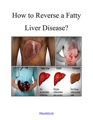 Http:adola.net
How to Reverse a Fatty
Liver Disease?
 