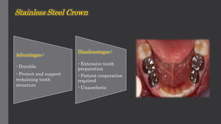 Stainless Steel Crown
Advantages :
- Durable
- Protect and support
remaining tooth
structure
Disadvantages :
- Extensive tooth
preparation
- Patient cooperation
required
- Unaesthetic
 