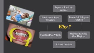 Why ?
Repair or Limit the
damage
Reestablish Adequate
Function
Maintaining Good
Oral Hygiene
Restore Esthetics
Maintain Pulp Vitality
Preserve the Tooth
Structure
 