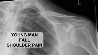 YOUNG MAN
FALL
SHOULDER PAIN
 