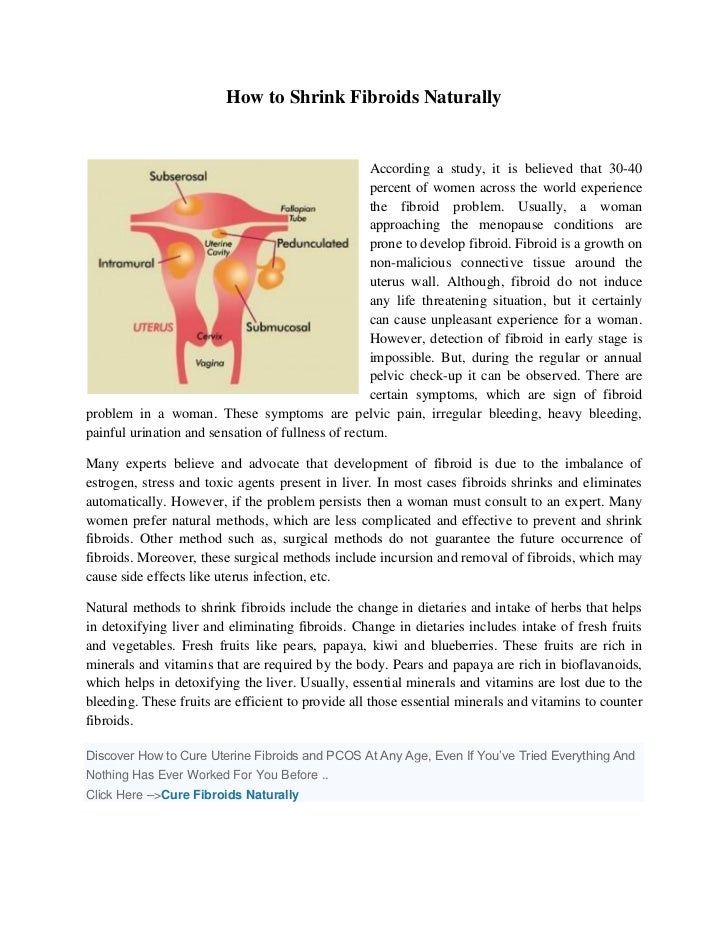 How to shrink fibroids naturally