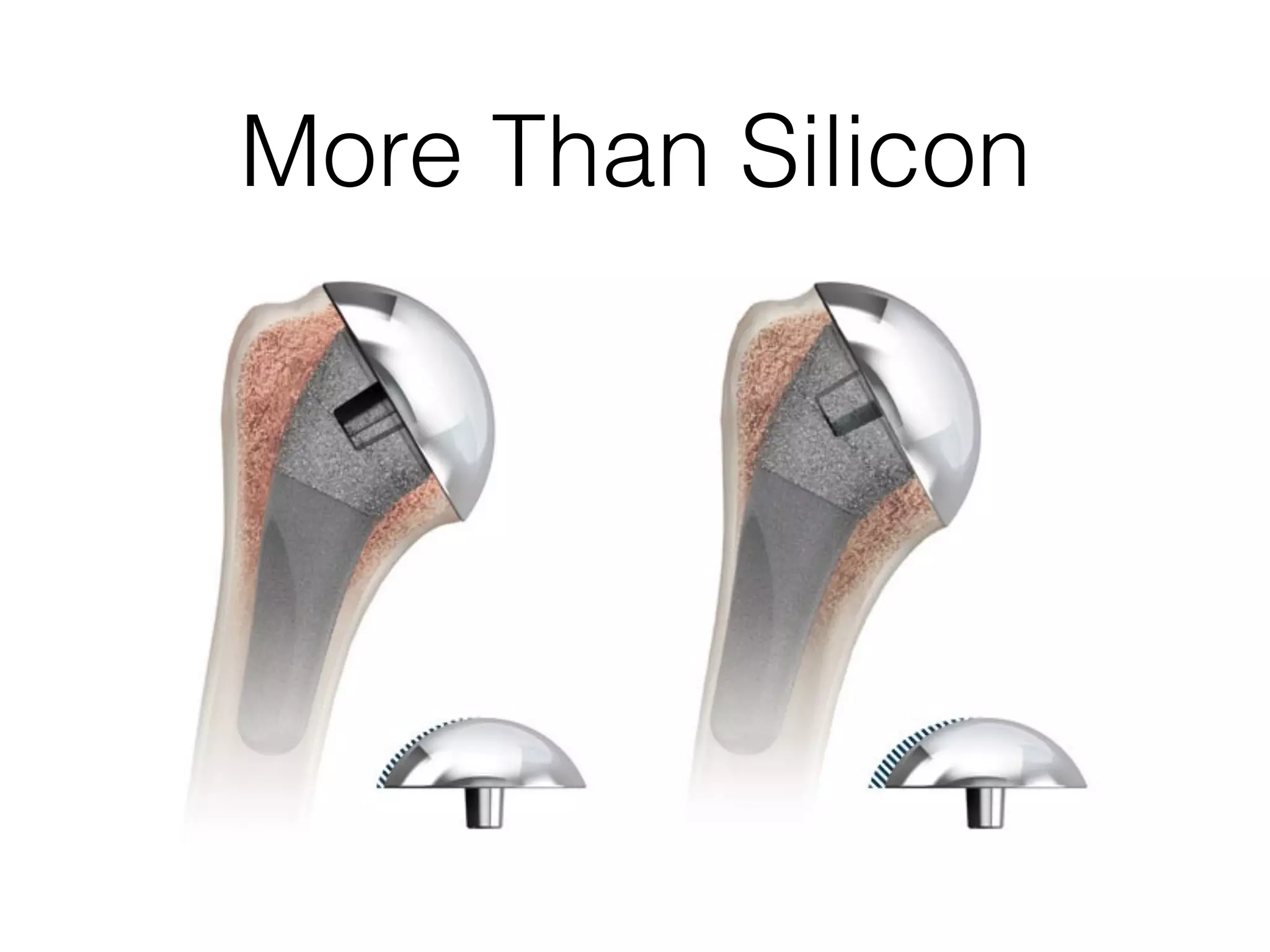 More Than Silicon
 