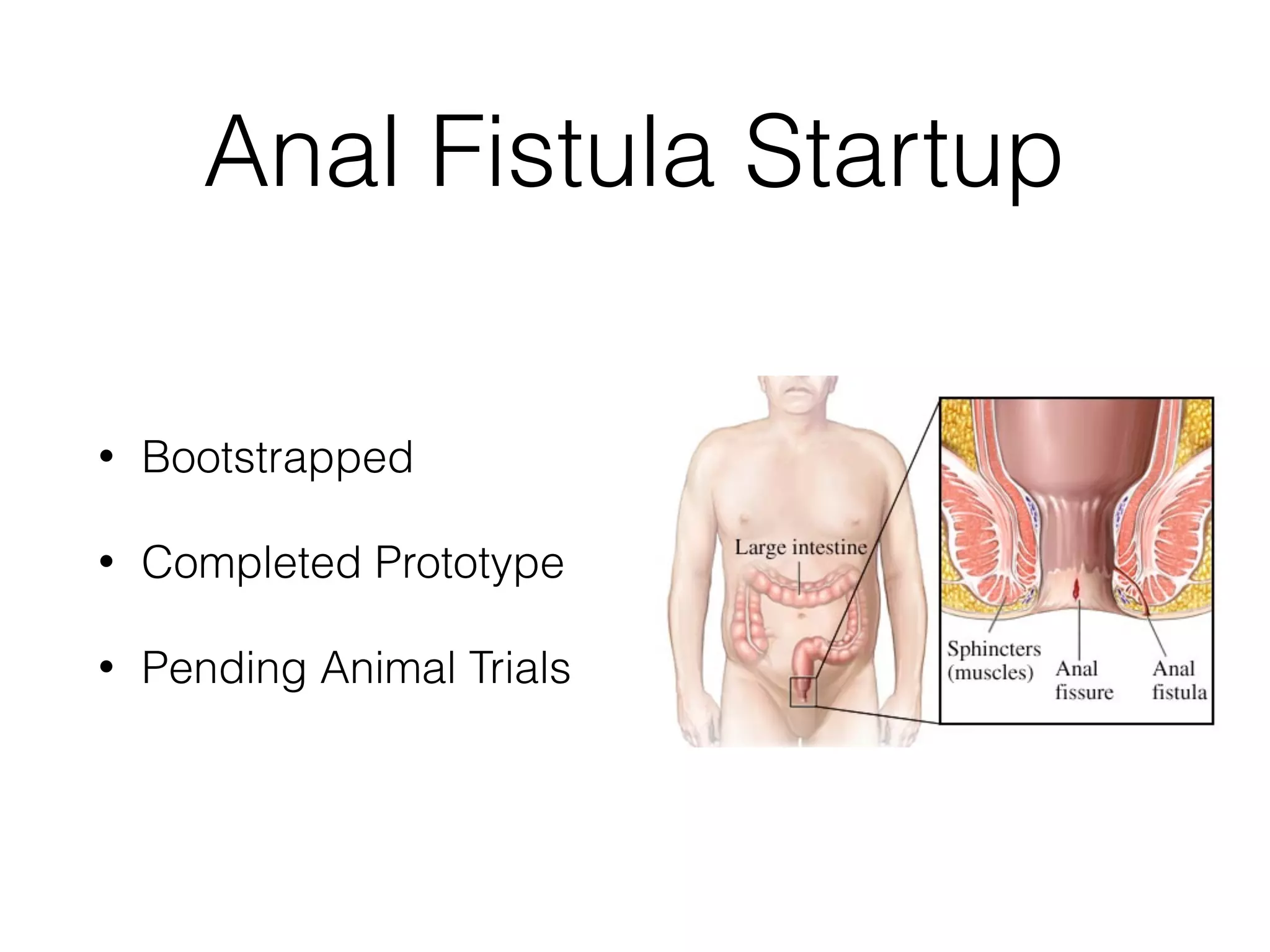 Anal Fistula Startup
• Bootstrapped
• Completed Prototype
• Pending Animal Trials
 