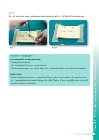 STEP 7
Cut the 3 ends with a suture cutting scissors leaving not less than 3 mm (¼-⅛ inch) of free suture ends.




 Step 7a                                                   Step 7b




  POINTS OF INTEREST
  Advantages of locked sutures include:
  • Increased tensile strength




                                                                                                                           Project E: How to place continuous interlocking sutures
  • Can be used in wounds under moderate tension
  • Useful in wounds oozing from the skin edges where it can assist with control of bleeding (hemostasis)


  Disadvantage:
  • Running locked sutures have an increased risk of impairing the microcirculation in the wound area, and
   they may cause tissue strangulation if placed too tightly. This type of suture should be used in areas with
   good blood supply e.g. the scalp.




                                                                                                                           96
                                                                                           The Apprentice Doctor® E-book
 