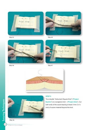 Step 4c                         Step 4d




                         Step 4e                         Step 4f




                                                      STEP 5
                                                      Tie a double “Instrument Square Knot” (“Project
Suturing Techniques




                                                      Epsilon”) or a surgeons knot – (“Project Zeta”). Cut
                                                      both ends of the suture leaving at least 3 mm (¼-⅛
                                                      inch) of suture material beyond the knot.




                         Step 5a


              99      The Apprentice Doctor® E-book
 