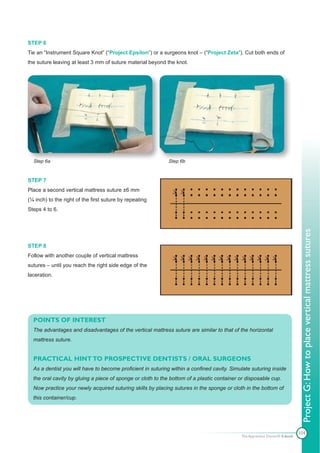 STEP 6
Tie an “Instrument Square Knot” (“Project Epsilon”) or a surgeons knot – (“Project Zeta”). Cut both ends of
the suture leaving at least 3 mm of suture material beyond the knot.




  Step 6a                                                   Step 6b


STEP 7
Place a second vertical mattress suture ±6 mm
(¼ inch) to the right of the first suture by repeating
Steps 4 to 6.




                                                                                                                             Project G: How to place vertical mattress sutures
STEP 8
Follow with another couple of vertical mattress
sutures – until you reach the right side edge of the
laceration.




  POINTS OF INTEREST
  The advantages and disadvantages of the vertical mattress suture are similar to that of the horizontal
  mattress suture.


  PRACTICAL HINT TO PROSPECTIVE DENTISTS / ORAL SURGEONS
  As a dentist you will have to become proficient in suturing within a confined cavity. Simulate suturing inside
  the oral cavity by gluing a piece of sponge or cloth to the bottom of a plastic container or disposable cup.
  Now practice your newly acquired suturing skills by placing sutures in the sponge or cloth in the bottom of
  this container/cup.




                                                                                                                            104
                                                                                            The Apprentice Doctor® E-book
 