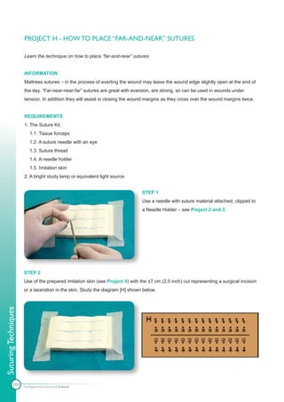 PROJECT H - HOW TO PLACE “FAR-AND-NEAR” SUTURES

                      Learn the technique on how to place “far-and-near” sutures


                      INFORMATION
                      Mattress sutures – in the process of everting the wound may leave the wound edge slightly open at the end of
                      the day. “Far-near-near-far” sutures are great with eversion, are strong, so can be used in wounds under
                      tension. In addition they will assist in closing the wound margins as they cross over the wound margins twice.


                      REQUIREMENTS
                      1. The Suture Kit
                          1.1. Tissue forceps
                          1.2. A suture needle with an eye
                          1.3. Suture thread
                          1.4. A needle holder
                          1.5. Imitation skin
                      2. A bright study lamp or equivalent light source


                                                                               STEP 1
                                                                               Use a needle with suture material attached, clipped to
                                                                               a Needle Holder – see Project 2 and 3.




                      STEP 2
                      Use of the prepared imitation skin (see Project 4) with the ±7 cm (2,5 inch) cut representing a surgical incision
                      or a laceration in the skin. Study the diagram [H] shown below.
Suturing Techniques




             105      The Apprentice Doctor® E-book
 