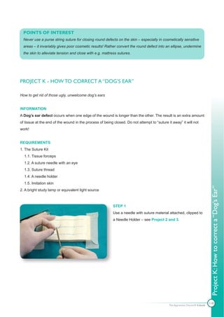 POINTS OF INTEREST
  Never use a purse string suture for closing round defects on the skin – especially in cosmetically sensitive
  areas – it invariably gives poor cosmetic results! Rather convert the round defect into an ellipse, undermine
  the skin to alleviate tension and close with e.g. mattress sutures.




PROJECT K - HOW TO CORRECT A “DOG’S EAR”

How to get rid of those ugly, unwelcome dog’s ears


INFORMATION
A Dog’s ear defect occurs when one edge of the wound is longer than the other. The result is an extra amount
of tissue at the end of the wound in the process of being closed. Do not attempt to “suture it away” it will not
work!


REQUIREMENTS
1. The Suture Kit
  1.1. Tissue forceps
  1.2. A suture needle with an eye
  1.3. Suture thread
  1.4. A needle holder
  1.5. Imitation skin




                                                                                                                              Project K: How to correct a “Dog’s Ear”
2. A bright study lamp or equivalent light source



                                                          STEP 1
                                                          Use a needle with suture material attached, clipped to
                                                          a Needle Holder – see Project 2 and 3.




                                                                                                                             118
                                                                                             The Apprentice Doctor® E-book
 