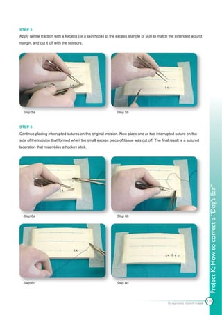 STEP 5
Apply gentle traction with a forceps (or a skin hook) to the excess triangle of skin to match the extended wound
margin, and cut it off with the scissors.




  Step 5a                                                    Step 5b



STEP 6
Continue placing interrupted sutures on the original incision. Now place one or two interrupted suture on the
side of the incision that formed when the small excess piece of tissue was cut off. The final result is a sutured
laceration that resembles a hockey stick.




  Step 6a                                                    Step 6b                                                          Project K: How to correct a “Dog’s Ear”




  Step 6c                                                    Step 6d




                                                                                                                             120
                                                                                             The Apprentice Doctor® E-book
 