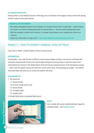 ALTERNATIVE METHOD:
                      Simply perform a neat elliptical excision of the dog’s ear as indicated on the diagram. Now proceed with placing
                      another couple of interrupted sutures.


                         POINTS OF INTEREST
                         • By making strategically placed cross markings on a surgical incision with a surgical pen – before making
                           the incision, you will be creating landmarks for closure later on – and thus avoid creating Dog’s ears.
                         • With the exception of quite minor incisions, it is always a good idea to use a surgical pen to plan your
                           incisions.
                         • Need more Information on dog’s ears? - http://www.dogfacts.org/hearing-dog-facts.htm



                      PROJECT L - HOW TO CORRECT UNEQUAL LEVELS OF TISSUE

                      Learn how to “flatten” unequal heights of tissue during suturing.


                      INFORMATION
                      Occasionally – even with the best of efforts to avoid unequal heights of tissue- one may be confronted with
                      somewhat unequal levels of skin at the wound edge during the suturing process. A common cause is the
                      mal-positioning of sutures in the deeper layers of the skin during a layered closure. If the discrepancy is large
                      – rather undo the deeper sutures and redo them at the correct level. If the discrepancy is slight – the method
                      described below will assist you to correct the problem with ease.


                      REQUIREMENTS
                      1. The Suture Kit
                         1.1. Tissue forceps
                         1.2. A suture needle with an eye
                         1.3. Suture thread
                         1.4. A needle holder
                         1.5. Imitation skin
                      2. A bright study lamp or equivalent light source


                                                                                STEP 1
Suturing Techniques




                                                                                Use a needle with suture material attached, clipped to
                                                                                a Needle Holder – see Project 2 and 3.




            121
                      The Apprentice Doctor® E-book
 