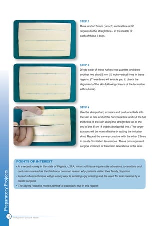 STEP 2
                                                                                  Make a short 5 mm (¼ inch) vertical line at 90
                                                                                  degrees to the straight line - in the middle of
                                                                                  each of these 3 lines.




                                                                                  STEP 3
                                                                                  Divide each of these halves into quarters and draw
                                                                                  another two short 5 mm (¼ inch) vertical lines in these
                                                                                  regions. (These lines will enable you to check the
                                                                                  alignment of the skin following closure of the laceration
                                                                                  with sutures).




                                                                                  STEP 4
                                                                                  Use the sharp-sharp scissors and push oneblade into
                                                                                  the skin at one end of the horizontal line and cut the full
                                                                                  thickness of the skin along the straight line up to the
                                                                                  end of the 11cm (4 inches) horizontal line. (The larger
                                                                                  scissors will be more effective in cutting the imitation
                                                                                  skin). Repeat the same procedure with the other 2 lines
                                                                                  to create 3 imitation lacerations. These cuts represent
                                                                                  surgical incisions or traumatic lacerations in the skin.




                          POINTS OF INTEREST
                          • In a recent survey in the state of Virginia, U.S.A, minor soft tissue injuries like abrasions, lacerations and
                            contusions ranked as the third most common reason why patients visited their family physician.
Preparatory Projects




                          • A neat suture technique will go a long way to avoiding ugly scarring and the need for scar revision by a
                            plastic surgeon
                          • The saying “practice makes perfect” is especially true in this regard!




                19     The Apprentice Doctor® E-book
 