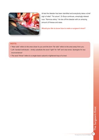 At last the bleeder has been identified and everybody takes a brief
                                             sigh of relief. “Tie suture”, Dr Buys continues, amazingly relaxed
                                             now. “Remove artery.” He ties off the bleeder with an amazing
                                             amount of finesse and ease.


                                             Would you like to know how to make a surgeon’s knot?




NOTE:
• “Near side” refers to the area closer to you and the term “far side” refers to the area away from you.
• Left- handed individuals – kindly substitute the word “right” for “left” and visa-versa. Apologies for any
 inconvenience!
• The word “throw” refers to a single basic subunit or tightened loop of a knot.




                                                                                                                            The Surgeon’s Knot




                                                                                                                            24
                                                                                            The Apprentice Doctor® E-book
 