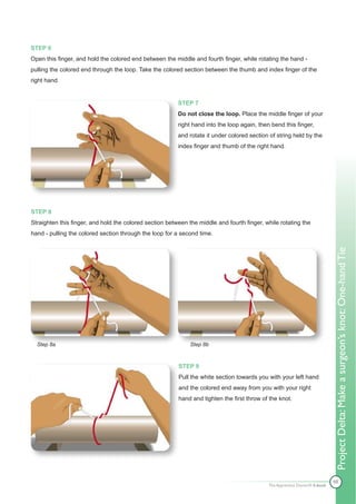 STEP 6
Open this finger, and hold the colored end between the middle and fourth finger, while rotating the hand -
pulling the colored end through the loop. Take the colored section between the thumb and index finger of the
right hand.


                                                         STEP 7
                                                         Do not close the loop. Place the middle finger of your
                                                         right hand into the loop again, then bend this finger,
                                                         and rotate it under colored section of string held by the
                                                         index finger and thumb of the right hand.




STEP 8
Straighten this finger, and hold the colored section between the middle and fourth finger, while rotating the
hand - pulling the colored section through the loop for a second time.




  Step 8a                                                     Step 8b                                                        Project Delta: Make a surgeon’s knot: One-hand Tie

                                                         STEP 9
                                                         Pull the white section towards you with your left hand
                                                         and the colored end away from you with your right
                                                         hand and tighten the first throw of the knot.




                                                                                                                             48
                                                                                             The Apprentice Doctor® E-book
 