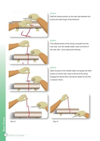 STEP 4
                                              Hold the colored section on the near side between the
                                              thumb and index finger of the left hand.




                                              STEP 5
                                              The colored section of the string is brought from the
                                              near side, over the needle holder, down and back to
                                              the near side – thus making the first loop.




                                              STEP 6
                                              Open the jaws of the needle holder and grasp the white
                                              section on the far side, close to the tip of the string.
                                              Engage the ratchet latch mechanism (listen for the first
                                              or second “click”).
Basic Knots




                 Step 7a                          Step 7b




        53
              The Apprentice Doctor® E-book
 