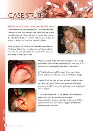 PERFORMING A SMALL MIRACLE! RHODE’S EAR
             One of those routine warnings by parents… “Rhodé and Michelle!
             Please don’t chase the dog around in the house!” And one of those
             inevitable outcomes – Rhodé falls and hits the side of her head on
             the coffee table “Ouch!” she exclaims, not thinking much about the
             incident, “…let’s go and have some cold drink Michelle”.


             Sitting on the couch in the family room Michelle notices blood on
             Rhodé’s ear “Rhodé, there’s blood on your ear!” Rhodé calls her
             mom, who discovers to her horror that a chunk of skin is missing
             from the top of her daughter’s ear!


                                                         Michelle goes back to the coffee table and discovers the missing
                                                         piece of skin. They place it in a container, add a small block of ice,
                                                         and rush off to the emergency department of the hospital!


                                                         Dr Wright has been on call for the past 12 hours and makes
                                                         himself ready to leave following a fairly quiet shift, for a change.


                                                         “Please Doctor,” the sister requests, “We have a young lady with
                                                         part of her ear missing!” Time is of the essence and Dr Wright
                                                         prepares to do a full thickness skin graft using the severed piece of
                                                         skin as the graft.


                                                         “Don’t look so worried, we’ll fix this like new,” He reassures the
                                                         patient and mother and starts with the procedure.
                                                         Local anesthetic… cleaning… suturing… and dressing. “Will the
                                                         injection hurt?”, ”How many stitches will I get?” Dr Wright talks
                                                         them through the procedure.
Case Study




       61
             The Apprentice Doctor® E-book
 