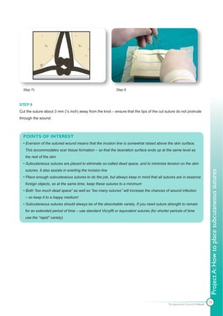 Step 7c                                                   Step 8



STEP 8
Cut the suture about 3 mm (⅛ inch) away from the knot – ensure that the tips of the cut suture do not protrude
through the wound.



  POINTS OF INTEREST
  • Eversion of the sutured wound means that the incision line is somewhat raised above the skin surface.
   This accommodates scar tissue formation – so that the laceration surface ends up at the same level as
   the rest of the skin
  • Subcutaneous sutures are placed to eliminate so-called dead space, and to minimize tension on the skin
   sutures. It also assists in everting the incision line




                                                                                                                          Project A: How to place subcutaneous sutures
  • Place enough subcutaneous sutures to do the job, but always keep in mind that all sutures are in essence
   foreign objects, so at the same time, keep these sutures to a minimum
  • Both “too much dead space” as well as “too many sutures” will increase the chances of wound infection
   – so keep it to a happy medium!
  • Subcutaneous sutures should always be of the absorbable variety. If you need suture strength to remain
   for an extended period of time – use standard Vicryl® or equivalent sutures (for shorter periods of time
   use the “rapid” variety).




                                                                                                                          76
                                                                                          The Apprentice Doctor® E-book
 
