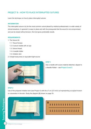 PROJECT B - HOW TO PLACE INTERRUPTED SUTURES

                      Learn the technique on how to place Interrupted sutures


                      INFORMATION
                      The interrupted suture is by far the most common suture placed by medical professionals in a wide variety of
                      clinical situations. In general it is easy to place and with the prerequisite that the wound is not compromised,
                      and can be closed without tension, this knot gives predictable results.


                      REQUIREMENTS
                      1. The Suture Kit
                          1.1. Tissue forceps
                          1.2. A suture needle with an eye
                          1.3. Suture thread
                          1.4. A needle holder
                          1.5. Imitation skin
                      2. A bright study lamp or equivalent light source


                                                                               STEP 1
                                                                               Use a needle with suture material attached, clipped to
                                                                               a Needle Holder – see Project 2 and 3.




                      STEP 2
                      Use of the prepared imitation skin (see Project 4) with the ±7 cm (2.5 inch) cut representing a surgical incision
                      or a laceration in the skin. Study the diagram [B] shown on page 78.
Suturing Techniques




               77     The Apprentice Doctor® E-book
 