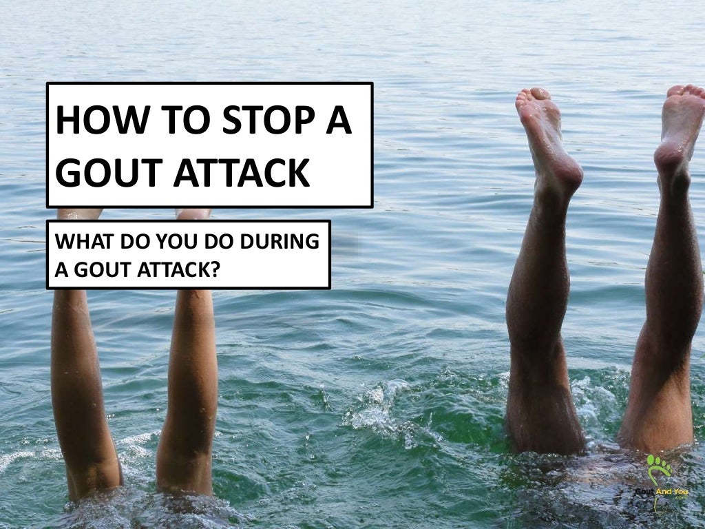 How to Stop a Gout Attack