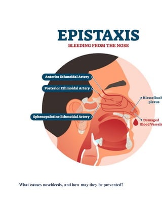 What causes nosebleeds, and how may they be prevented?
 