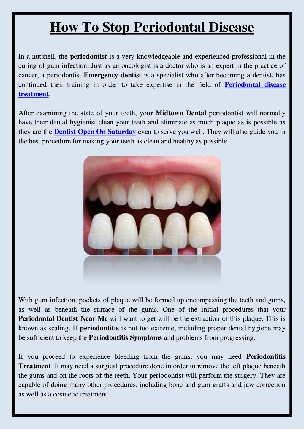 How to stop periodontal disease